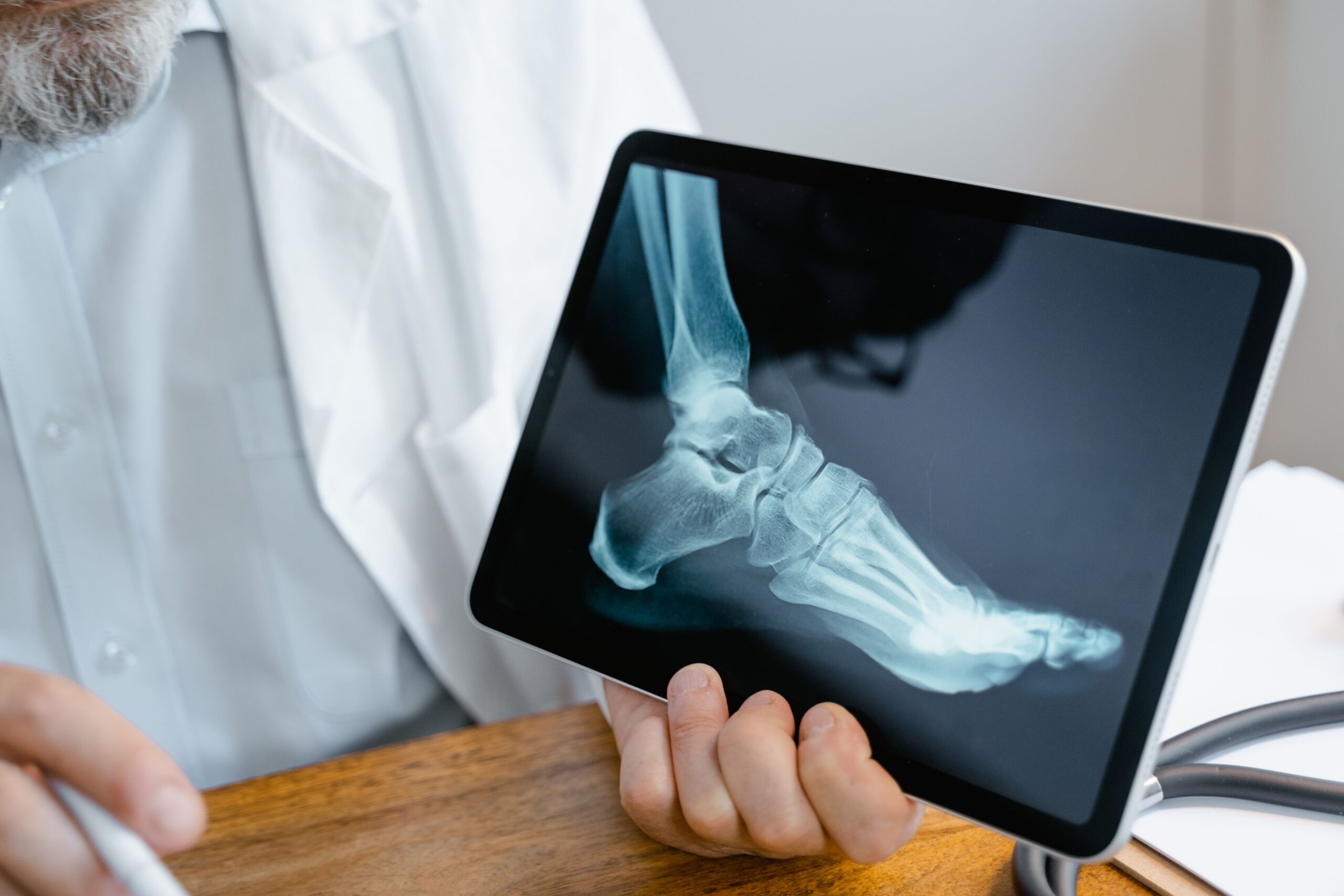 Broke a Bone in a Public Fall in Illinois? Don’t Settle Yet